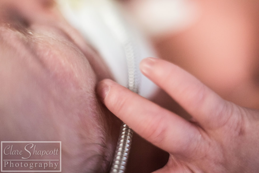 Picture of premature baby touching eye and breathing tube