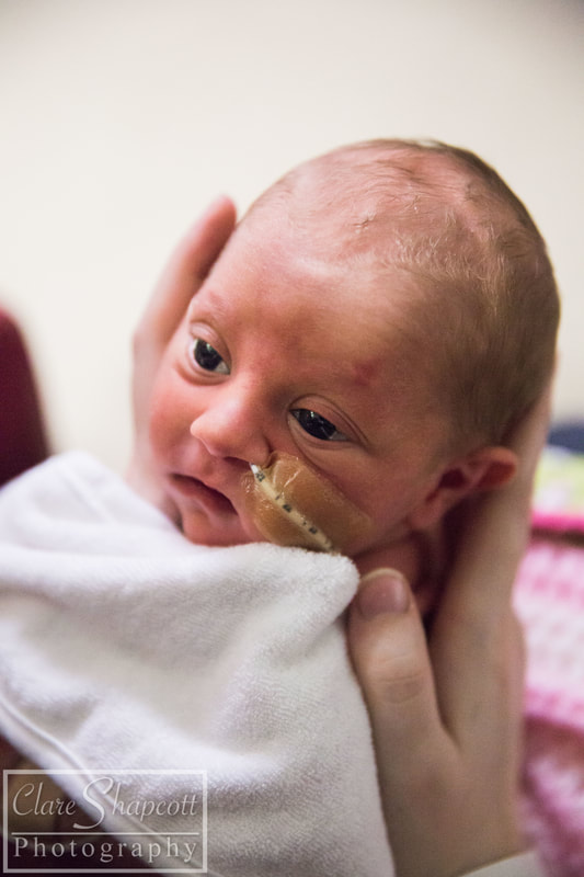 Photograph of premature baby with feeding tube held by mother