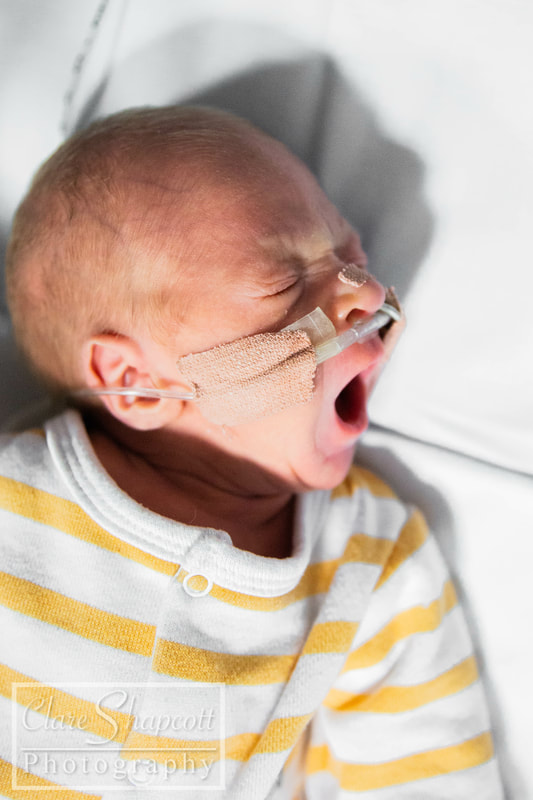 Picture of premature baby yawning with cannula