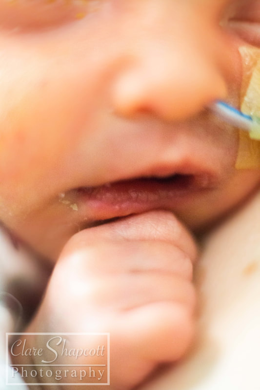 Close up image of NICU baby's lips - Southmead Hospital.